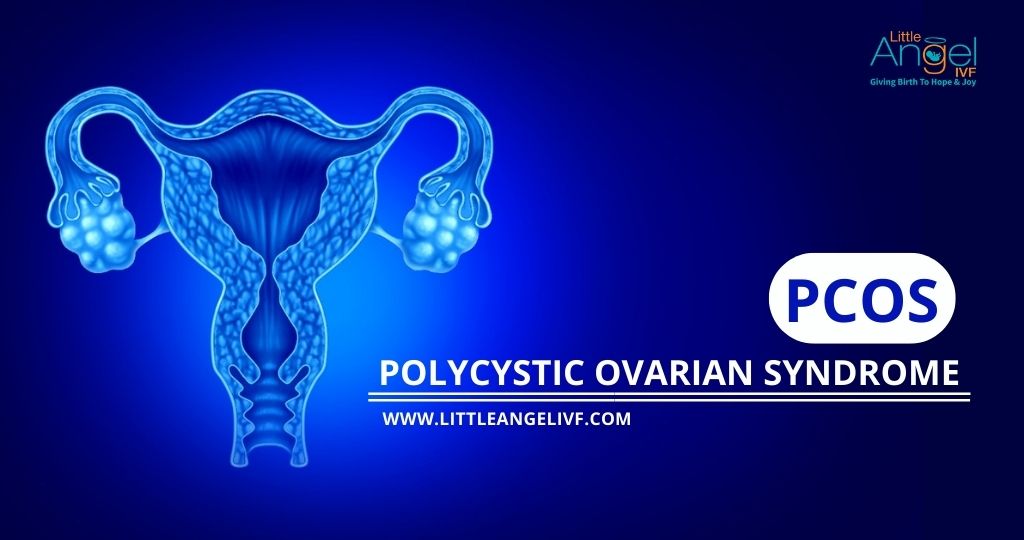 PCOD VS PCOS | Difference Between PCOS and PCOD