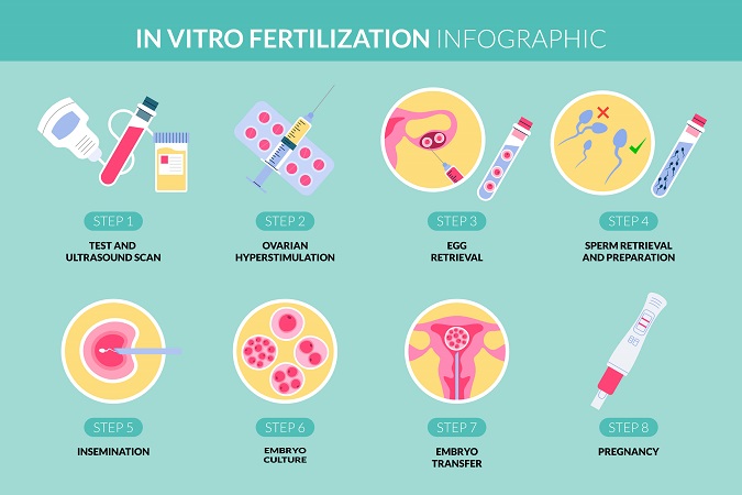 In Vitro Fertilization (IVF)