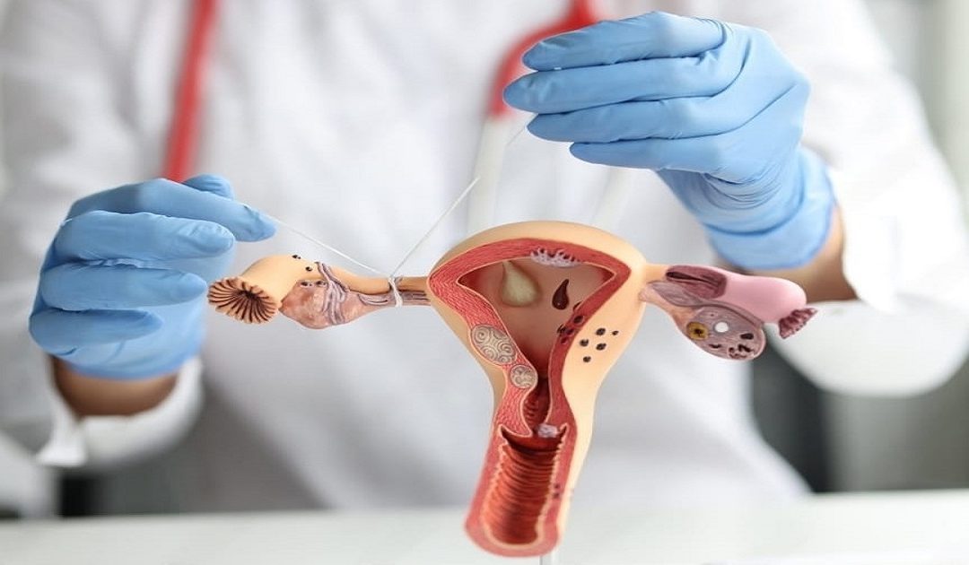 Blocked Fallopian Tubes: Symptoms, Causes & Treatment