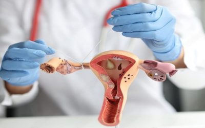 Blocked Fallopian Tubes: Symptoms, Causes & Treatment