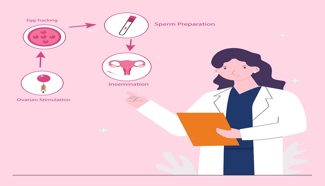 IUI Treatment Cost & IUI Success Rate In India