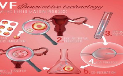 What Is IVF Process/Procedure & How Does IVF Works?