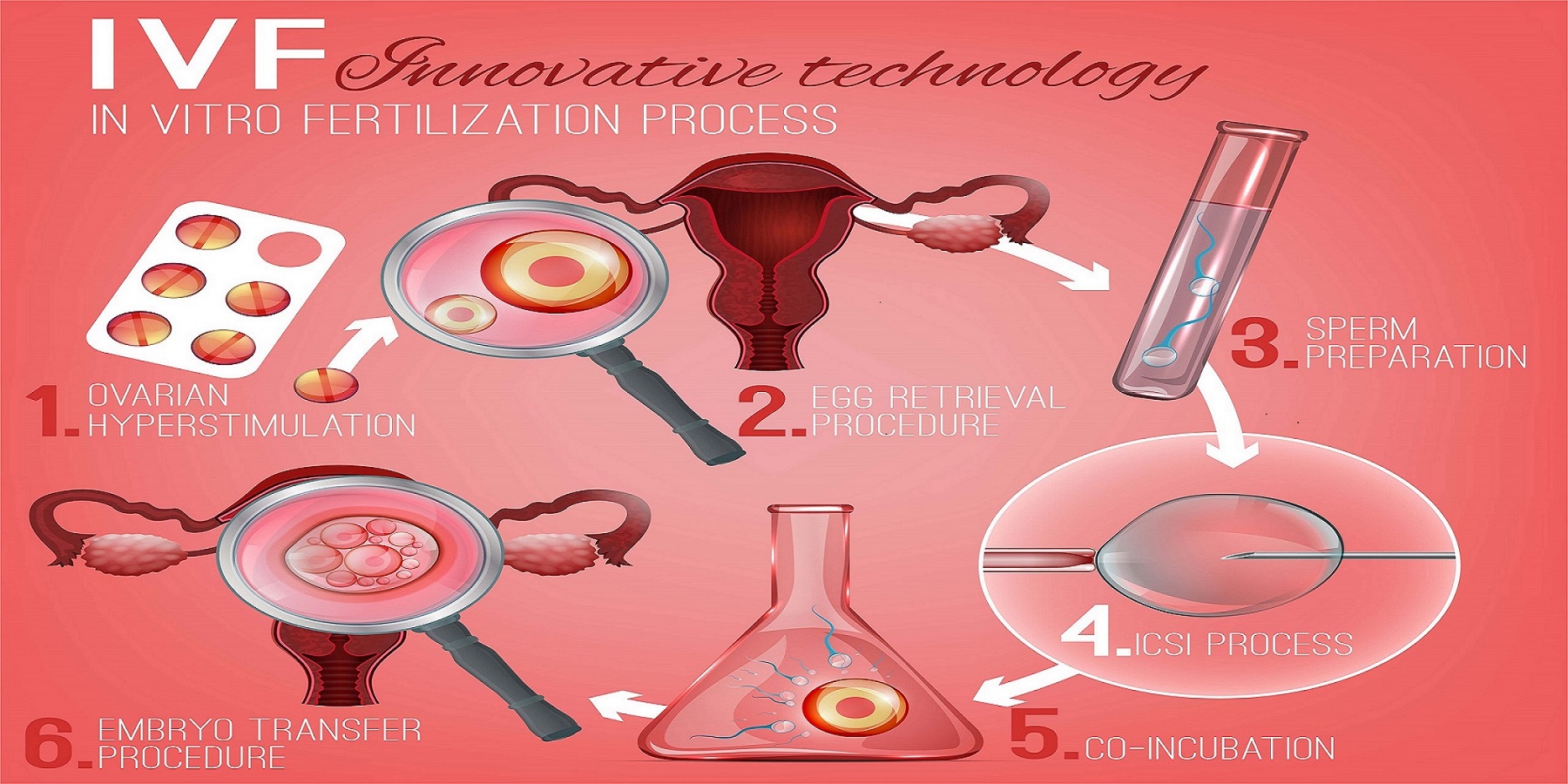 IVF Process Step By Step