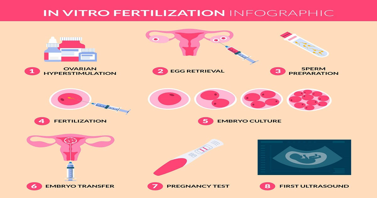 IVF Kya Hai | IVF Process Step by Step in Hindi