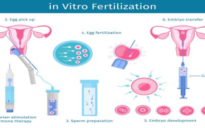 IVF Procedure Step By Step: IVF Process Start to Finish