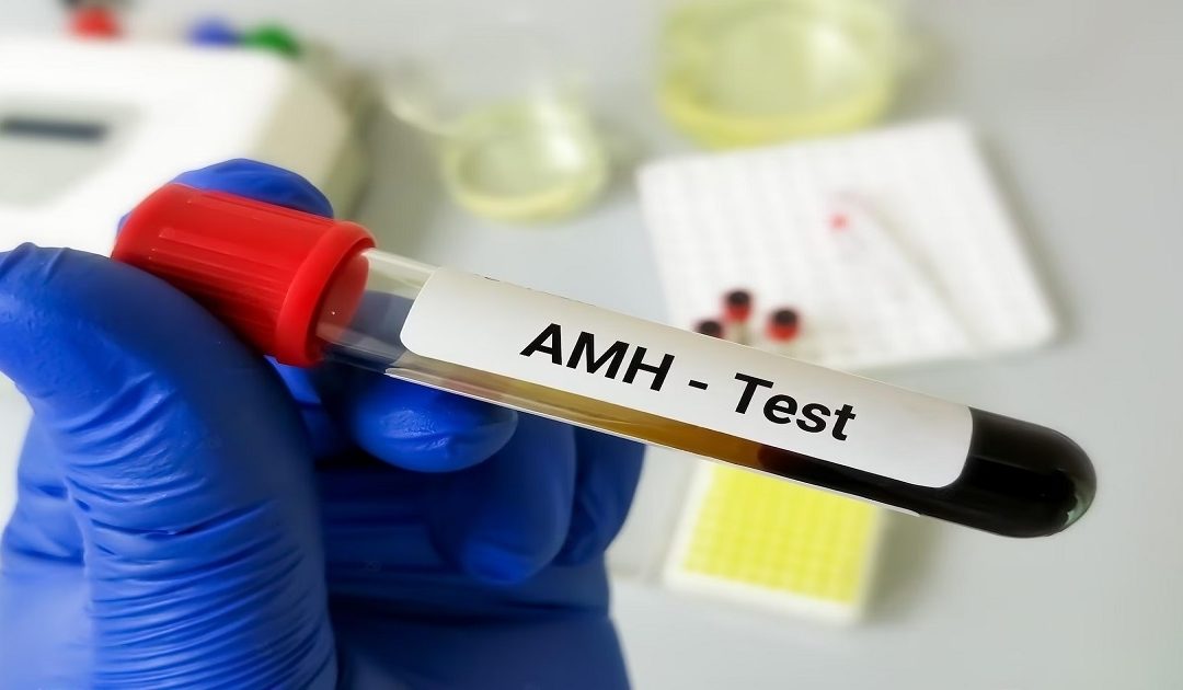 (Anti Mullerian Hormone) AMH Test Price/Cost