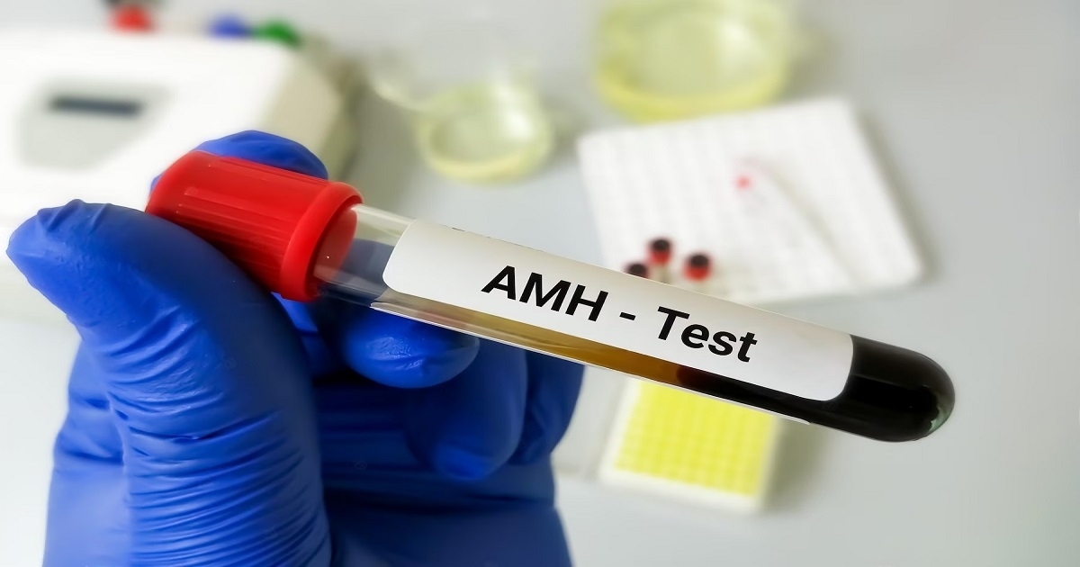 AMH Test Price