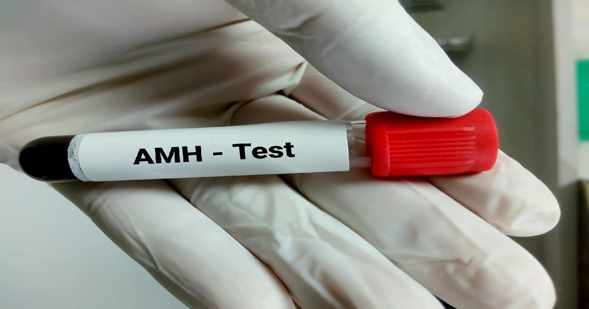 AMH Test Result