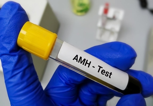 AMH Test