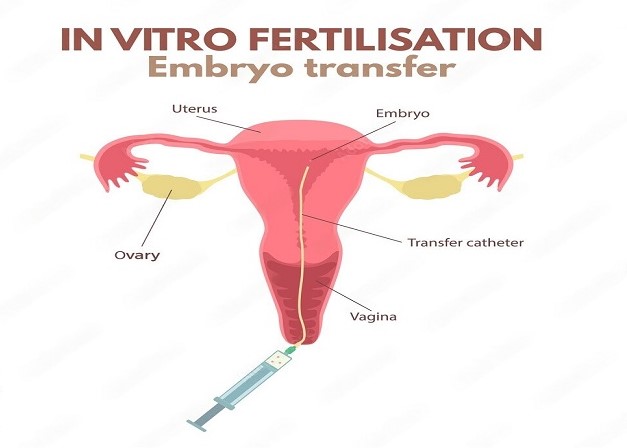 Embryo Transfer