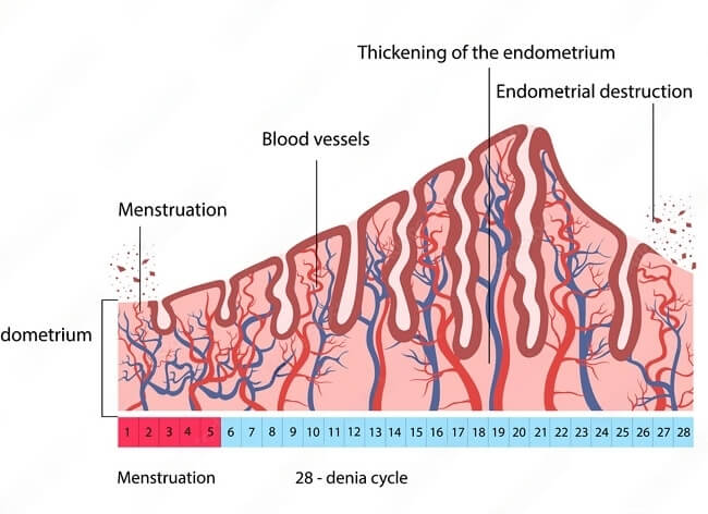 What Is The Endometrium Thickening Types And Pathologies 60 OFF