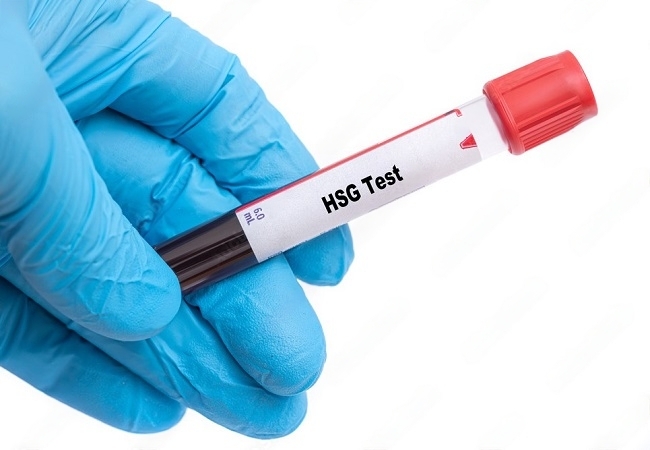 HSG Test Cost in 2023