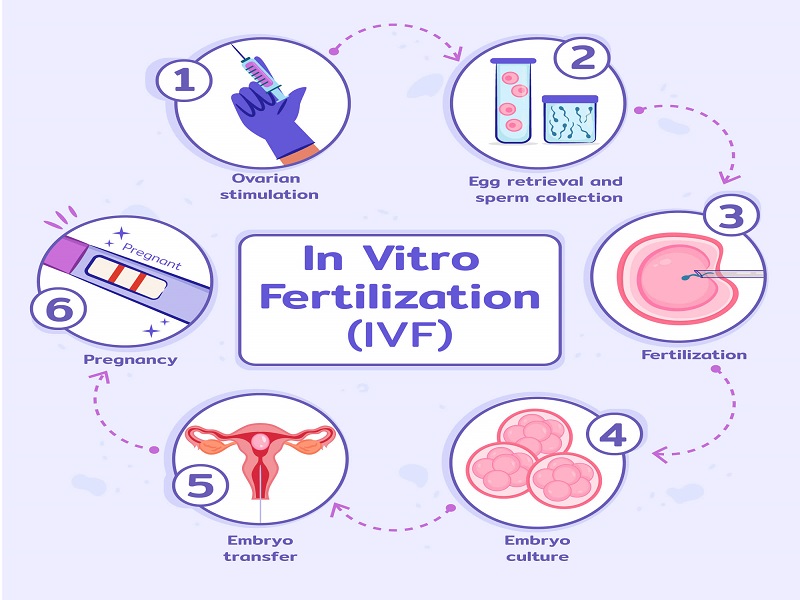 IVF Process