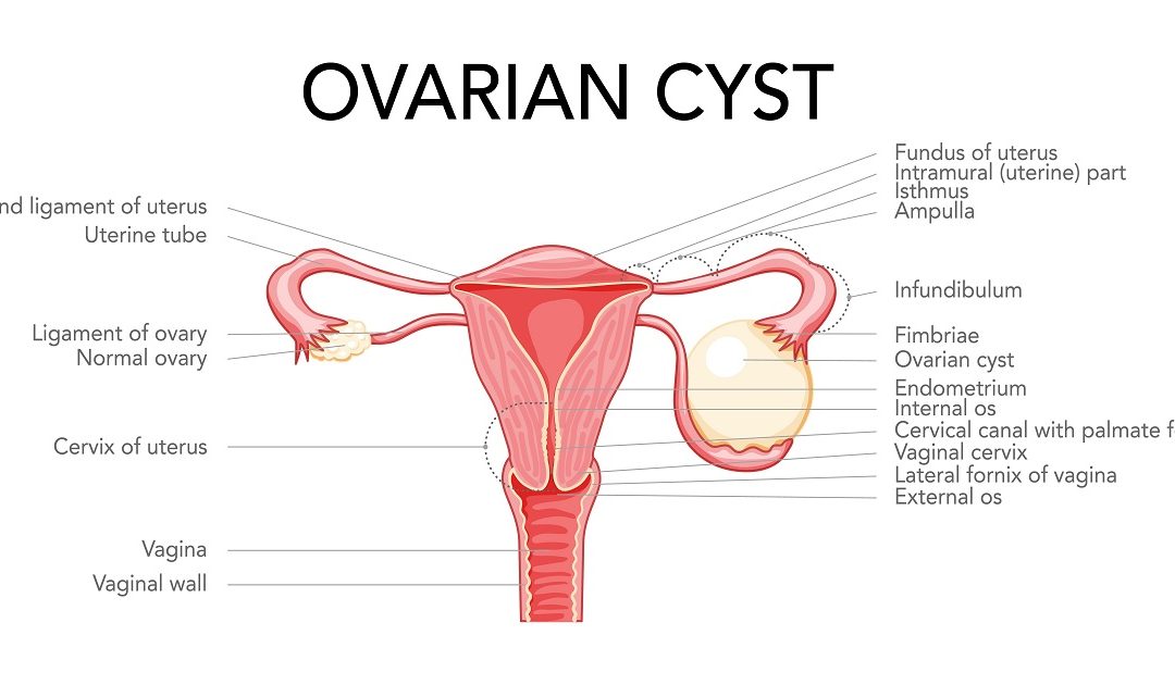 What is Cyst Meaning in Hindi (Cyst Kya Hota Hai)?