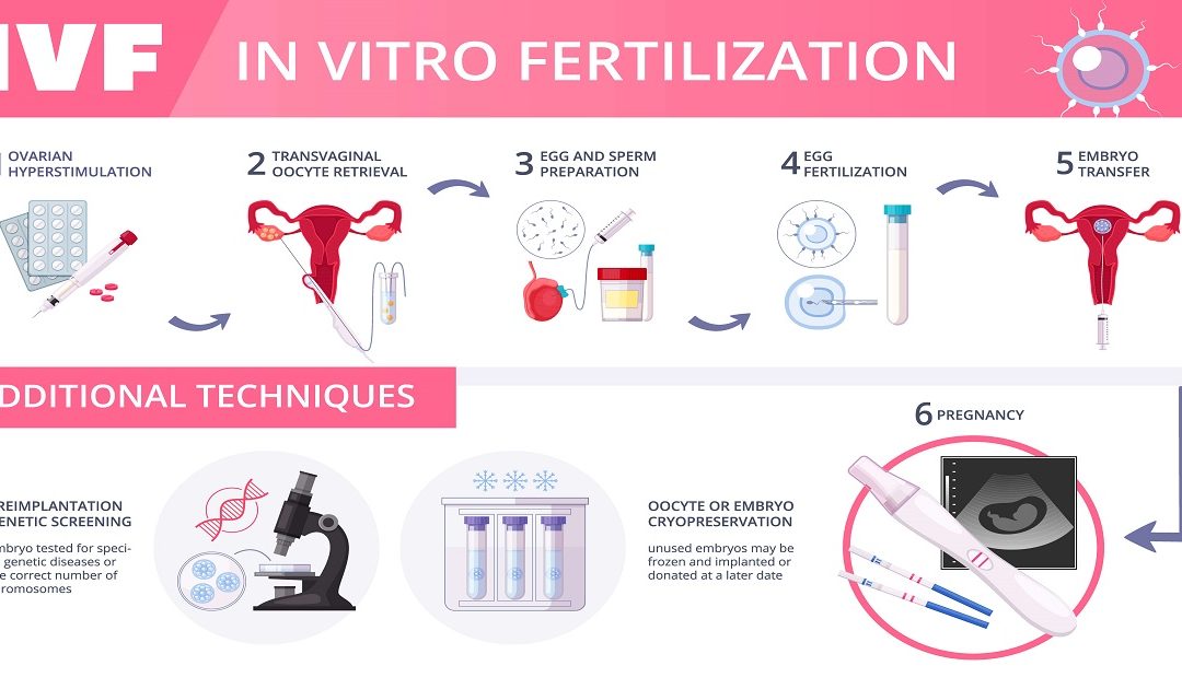What Are the 5 Stages of IVF?