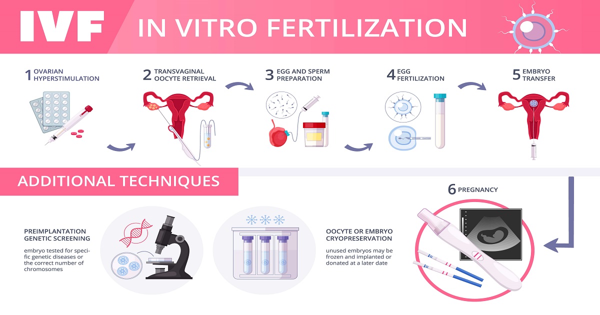 5 Stages of IVF