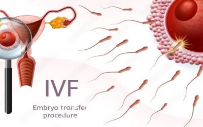 Embryo Transfer Technology In IVF