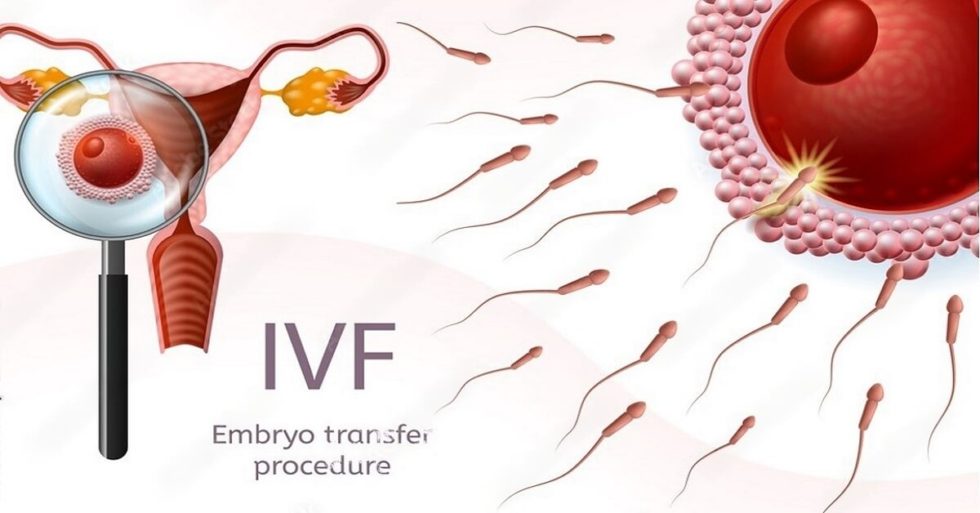 Embryo Transfer technology In IVF Treatment DrMona Dahiya