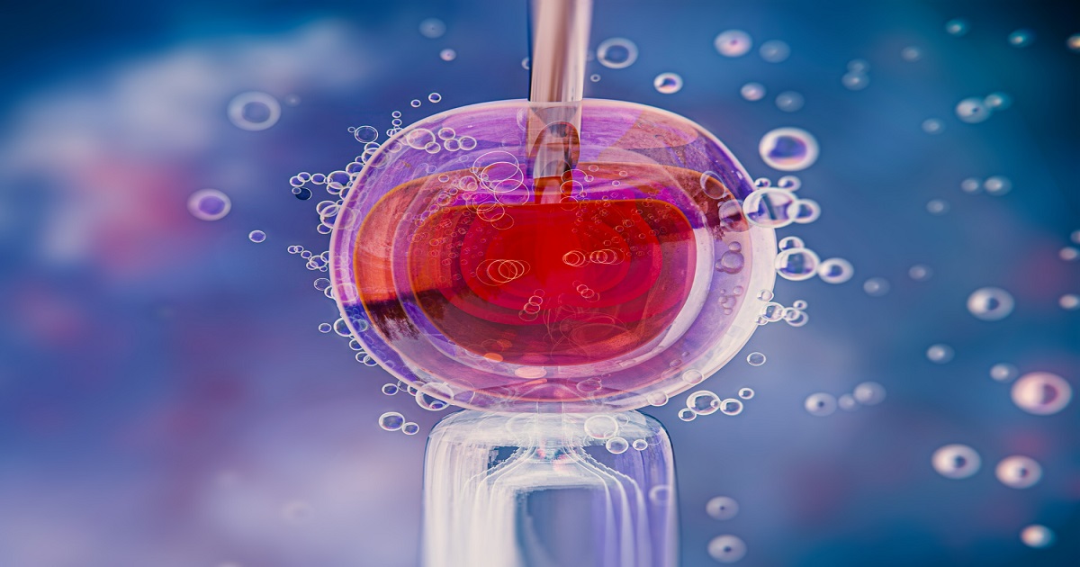 ICSI IVF