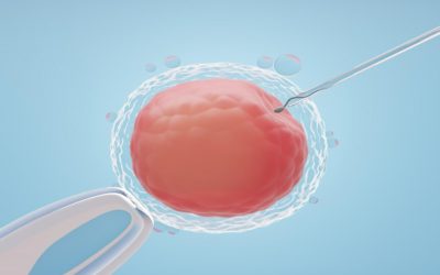 IVF Embryo Transfer: Procedure, Risk & Cost