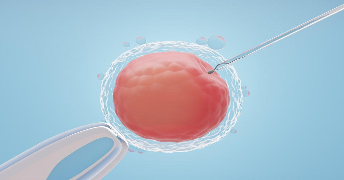 IVF Embryo Transfer