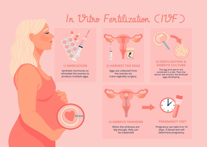 IVF Process