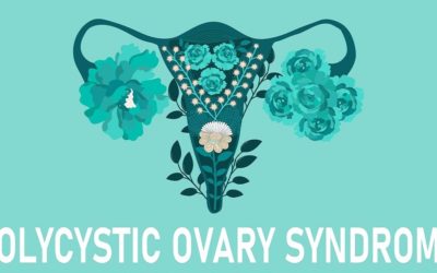 PCOS Treatment: How to Cure PCOS Permanently?