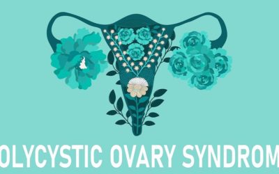 PCOS Treatment: How to Cure PCOS Permanently?