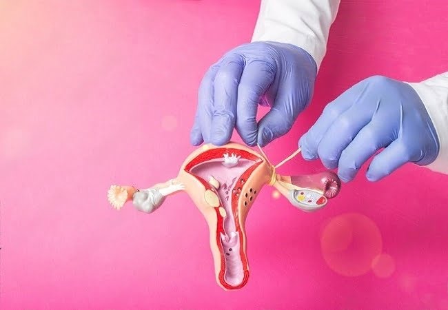 Chances of Getting Pregnant after Tubal Ligation | SheCares