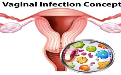 How Does Vaginal Infections Affect Fertility?
