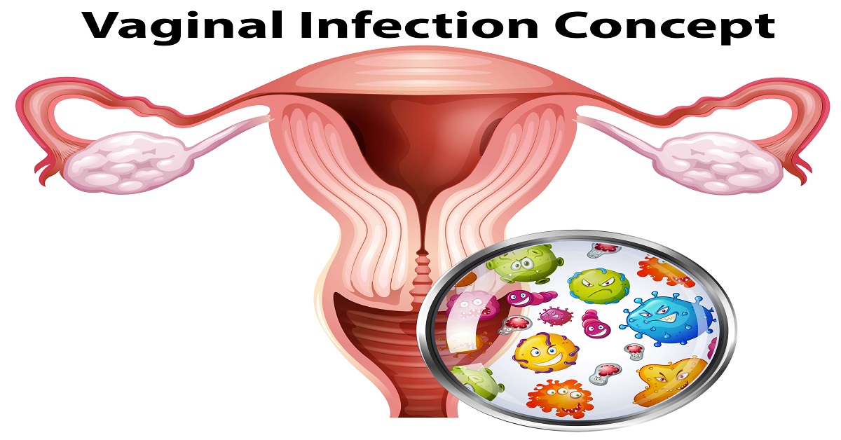 Does Vaginal Infections Affect Fertility