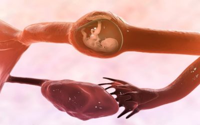 Ectopic Pregnancy: Symptoms, Causes & Treatment