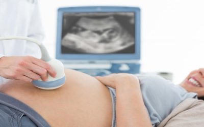 What is Follicular Monitoring Ultrasound?