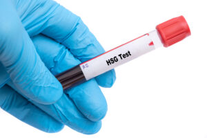 HSG Test