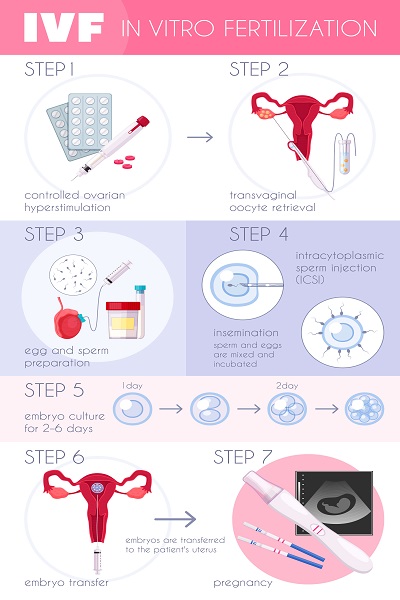 IVF Process