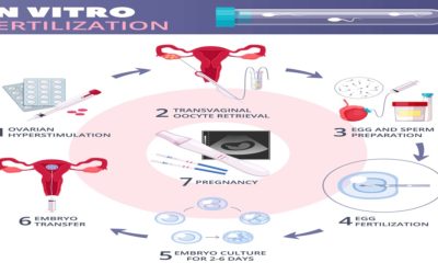 How Long Does IVF Take from start to finish?