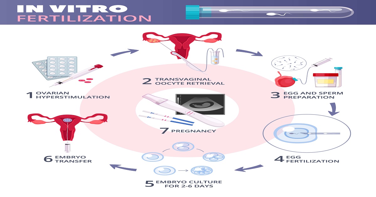 IVF Timeline