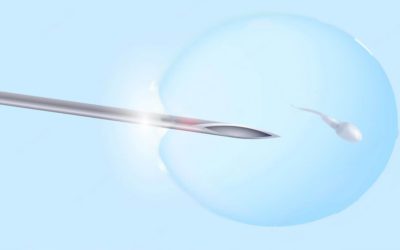 What is IVF with Laser Assisted Hatching (LAH)?