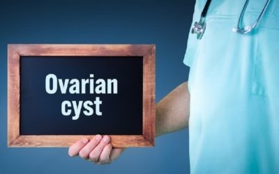 Ovarian Cyst: Symptoms, Treatment & Causes