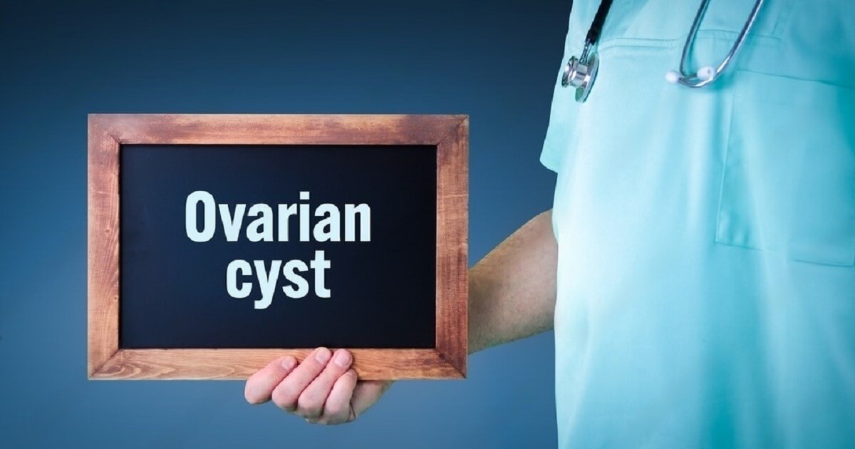 12 Ruptured Ovarian Cyst Symptoms and Treatment Options