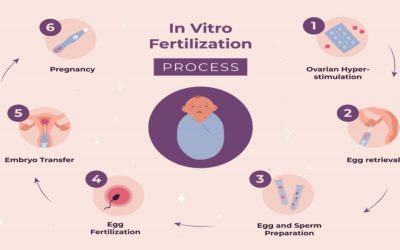 Short or Long IVF Protocol: Which is Better?