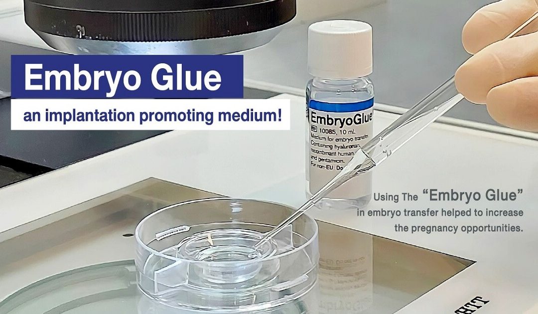 What is Embryo Glue & it’s Role in IVF?