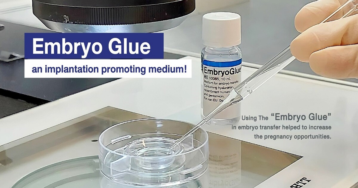 Embryo Glue Role in IVF