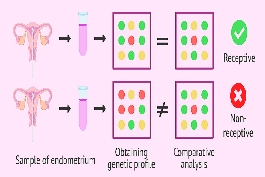 Endometrial Receptivity Analysis Test Result