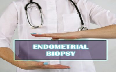 Endometrial Biopsy for Infertility Treatment