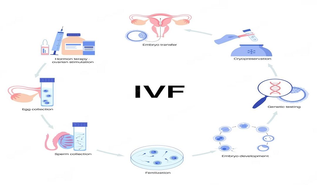 Mild IVF: Benefit, Success Rate & Cost