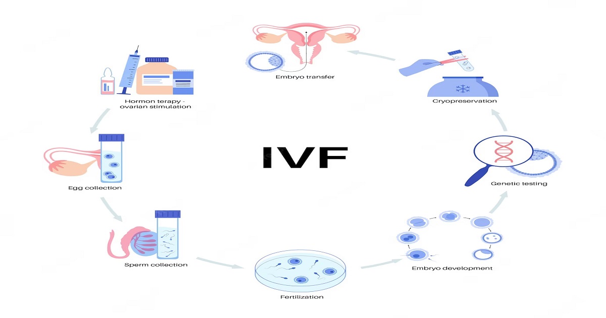 Mild IVF