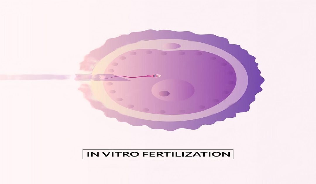 Mini IVF: Benefit, Success Rate & Cost