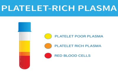 PRP Procedure in IVF for Infertility Treatment