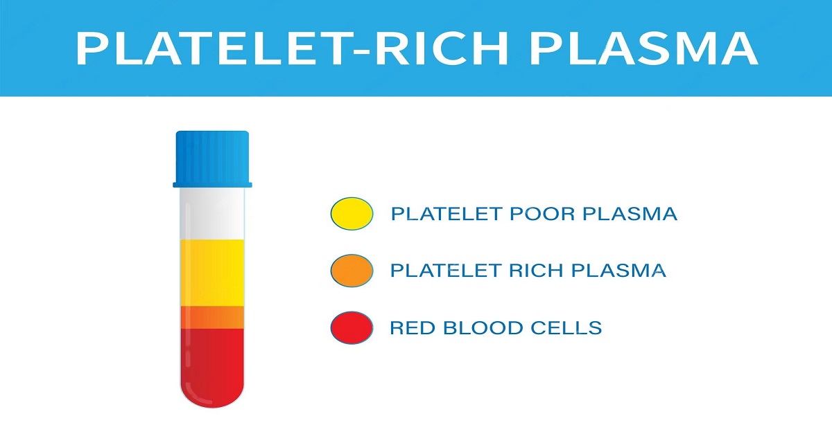 PRP in IVF